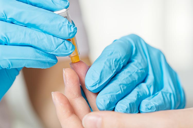 ドロップスクリーンのイメージ写真