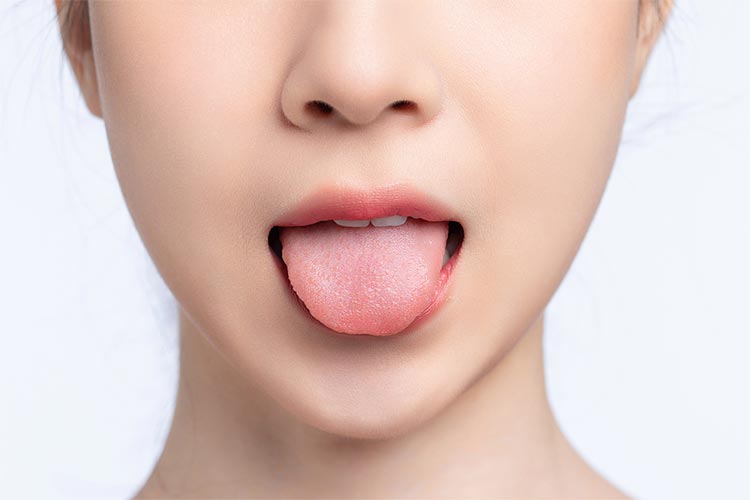 舌下免疫療法のイメージ写真